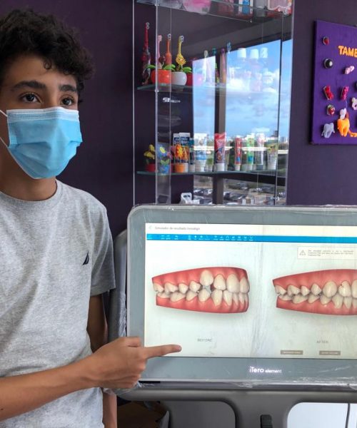 Tecnologia Odontoinfant